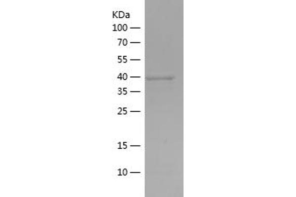 ACTC1 Protein (AA 236-368) (His-IF2DI Tag)