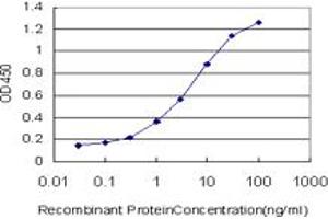 Detection limit for recombinant GST tagged TBL1X is approximately 0. (TBL1X antibody  (AA 478-577))