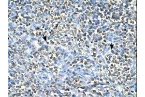 Image no. 1 for anti-Asialoglycoprotein Receptor 2 (ASGR2) (AA 106-155) antibody (ABIN203049) (Asialoglycoprotein Receptor 2 antibody  (AA 106-155))