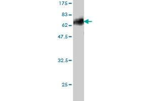 Western Blot detection against Immunogen (57. (DLX3 antibody  (AA 1-287))