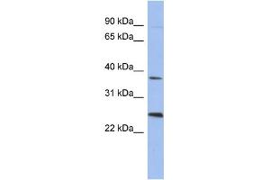 WB Suggested Anti-MAGEB2 Antibody Titration: 0. (MAGEB2 antibody  (N-Term))