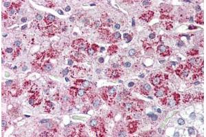 Adrenal, Human: Formalin-Fixed, Paraffin-Embedded (FFPE) (NTSR2 antibody  (Internal Region))