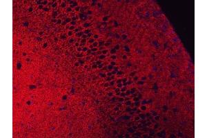 anti-Solute Carrier Family 1 (Glial High Affinity Glutamate Transporter), Member 2 (SLC1A2) (AA 461-574) antibody