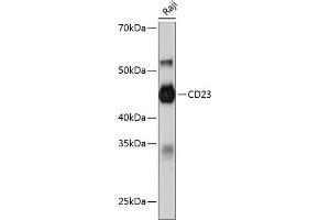 Western blot analysis of extracts of Raji cells, using CD23 Rabbit mAb (ABIN7267160) at 1:1000 dilution.