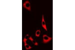 Immunofluorescent analysis of MRP8 staining in MCF7 cells. (S100A8 antibody)