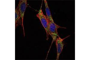 Immunofluorescence analysis of NIH/3T3 cells using SMAD4 mouse mAb (green). (SMAD4 antibody)