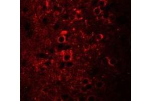 Immunofluorescence of CCDC55 in mouse brain cells with CCDC55 antibody at 20 ug/mL. (NSRP1 antibody  (C-Term))