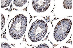 IHC analysis of RRS1 using anti-RRS1 antibody (ABIN7601344). (RRS1 antibody  (AA 33-266))