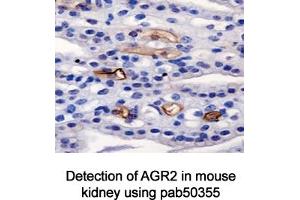 Image no. 3 for anti-Anterior Gradient Homolog 2 (Xenopus Laevis) (AGR2) (AA 50-100) antibody (ABIN363664) (AGR2 antibody  (AA 50-100))