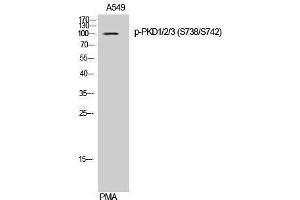Western Blotting (WB) image for anti-Polycystic Kidney Disease 1/2/3 (PKD1/2/3) (pSer738), (pSer742) antibody (ABIN3182590) (PKD1/2/3 antibody  (pSer738, pSer742))