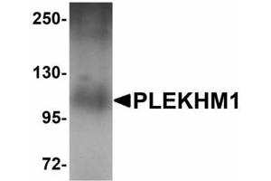 Image no. 1 for anti-Pleckstrin Homology Domain Containing, Family M (With RUN Domain) Member 1 (PLEKHM1) (N-Term) antibody (ABIN478196) (PLEKHM1 antibody  (N-Term))