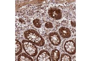 Immunohistochemical staining of human rectum with GPATCH8 polyclonal antibody  shows strong cytoplasmic and nuclear positivity in glandular cells. (GPATCH8 antibody)