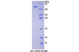 SDS-PAGE analysis of Mouse Estrogen Receptor 2 Protein. (ESR2 Protein)