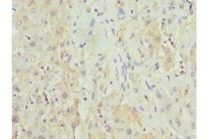 Immunohistochemistry of paraffin-embedded human liver tissue using ABIN7155891 at dilution of 1:100 (HGD antibody  (AA 226-445))