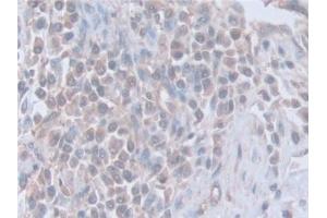 Immunohistochemistry (IHC) image for anti-Synaptosomal-Associated Protein, 23kDa (SNAP23) (AA 1-211) antibody (ABIN7444214)