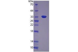Image no. 1 for Utrophin (UTRN) (AA 1-252) protein (His tag) (ABIN4990490)
