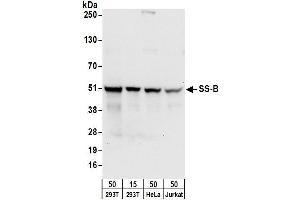 Western Blotting (WB) image for anti-Sjogren Syndrome Antigen B (SSB) (AA 358-408) antibody (ABIN7453946) (SSB antibody  (AA 358-408))