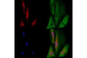 ABIN7094588 and ABIN7098637 staining  cells by IF/ICC.