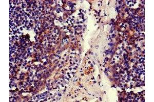Immunohistochemistry of paraffin-embedded human tonsil tissue using ABIN7159312 at dilution of 1:100 (MFI2 antibody  (AA 20-302))