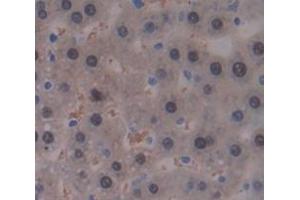 IHC-P analysis of Rat Tissue, with DAB staining. (GALT antibody  (AA 1-379))