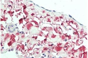 Human Lung, Pleura: Formalin-Fixed, Paraffin-Embedded (FFPE) (OGN antibody  (AA 246-276))