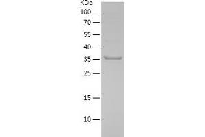 GSTO1 Protein (AA 132-241) (His-IF2DI Tag)