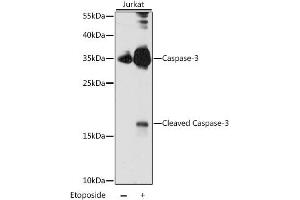 Western blot analysis of extracts of Jurkat cells, using CASP3 antibody (ABIN6292881) at 1:1000 dilution. (Caspase 3 antibody)