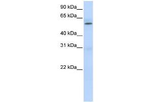 Western Blotting (WB) image for anti-Protein Arginine Methyltransferase 3 (PRMT3) antibody (ABIN2458480) (PRMT3 antibody)