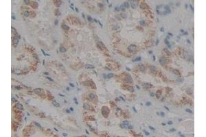 #VALUE! (LOR antibody)