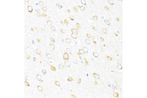 Immunohistochemistry of paraffin-embedded rat brain using DDX3Y antibody (ABIN6130260, ABIN6139496, ABIN6139497 and ABIN6215395) at dilution of 1:100 (40x lens). (DDX3Y antibody  (AA 1-210))