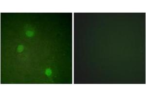 Immunofluorescence analysis of HeLa cells, using AurB (Ab-232) Antibody. (Aurora Kinase B antibody  (AA 198-247))