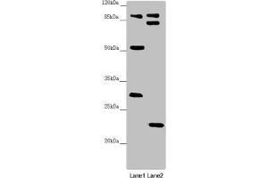 Western blot All lanes: KANSL3 antibody at 1. (KANSL3 antibody  (AA 1-200))