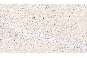 Detection of ADIPOR2 in Human Liver Tissue using Polyclonal Antibody to Adiponectin Receptor 2 (ADIPOR2) (Adiponectin Receptor 2 antibody  (AA 2-155))