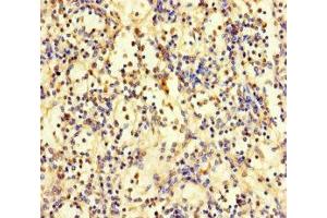 Immunohistochemistry of paraffin-embedded human spleen tissue using ABIN7176159 at dilution of 1:100 (ZNF221 antibody  (AA 1-300))