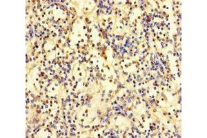 Immunohistochemistry of paraffin-embedded human spleen tissue using ABIN7176159 at dilution of 1:100 (ZNF221 antibody  (AA 1-300))