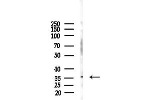 anti-Kruppel-Like Factor 2 (Lung) (KLF2) (Internal Region) antibody