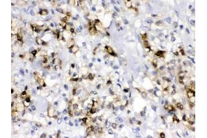 IHC analysis of CA2 using anti- CA2 antibody . (CA2 antibody  (AA 2-260))