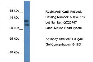Western Blotting (WB) image for anti-Potassium Channel, Subfamily T, Member 1 (KCNT1) (C-Term) antibody (ABIN2783808) (KCNT1 antibody  (C-Term))