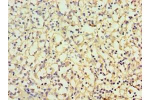 Immunohistochemistry of paraffin-embedded human spleen tissue using ABIN7146745 at dilution of 1:100 (CBR3 antibody  (AA 118-277))