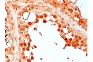 ABIN2560635 (2µg/ml) staining of paraffin embedded Human Testis. (UBE2R2 antibody  (N-Term))