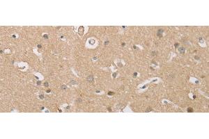 Immunohistochemistry of paraffin-embedded Human brain tissue using P2RY11 Polyclonal Antibody at dilution of 1:30(x200) (P2RY11 antibody)