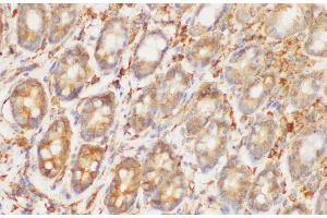 Immunohistochemistry of paraffin-embedded Rat colon using HRAS Polycloanl Antibody at dilution of 1:200 (HRAS antibody)