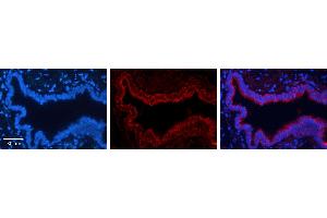 TKT antibody - N-terminal region          Formalin Fixed Paraffin Embedded Tissue:  Human Bronchial Epithelial Tissue    Observed Staining:  Cytoplasm of bronchial epithelial tissue   Primary Antibody Concentration:  1:100    Secondary Antibody:  Donkey anti-Rabbit-Cy3    Secondary Antibody Concentration:  1:200    Magnification:  20X    Exposure Time:  0. (TKT antibody  (N-Term))