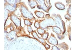 Formalin-fixed, paraffin-embedded human placenta stained with hCG beta antibody (HCGb/54 + HCGb/459).
