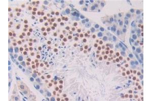 Detection of PNOC in Mouse Testis Tissue using Polyclonal Antibody to Pronociceptin (PNOC) (Pronociceptin (AA 12-187) antibody)