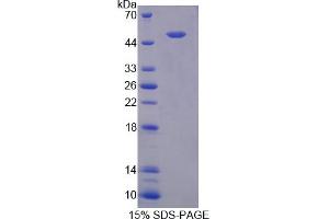 Image no. 1 for Surfactant Protein C (SFTPC) (AA 1-194) protein (His tag,GST tag) (ABIN4988784)