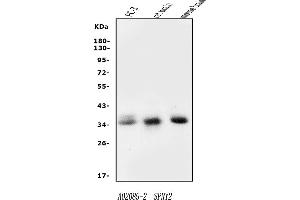 Western blot analysis of Spry-2/SPRY2 using anti-Spry-2/SPRY2 antibody (ABIN7599261).