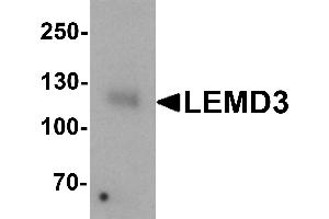 Western blot analysis of LEMD3 in human colon tissue lysate with LEMD3 antibody at 1 µg/mL. (LEMD3 antibody  (C-Term))