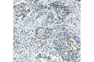 IHC analysis of PRDM5 using anti-PRDM5 antibody (ABIN7600853).