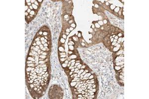 Immunohistochemical staining (Formalin-fixed paraffin-embedded sections) of human colon with MIPEP polyclonal antibody  shows moderate cytoplasmic positivity in glandular cells. (MIPEP antibody)